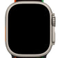 Apple Watch Uyumlu Spor Loop Kordon Blackity